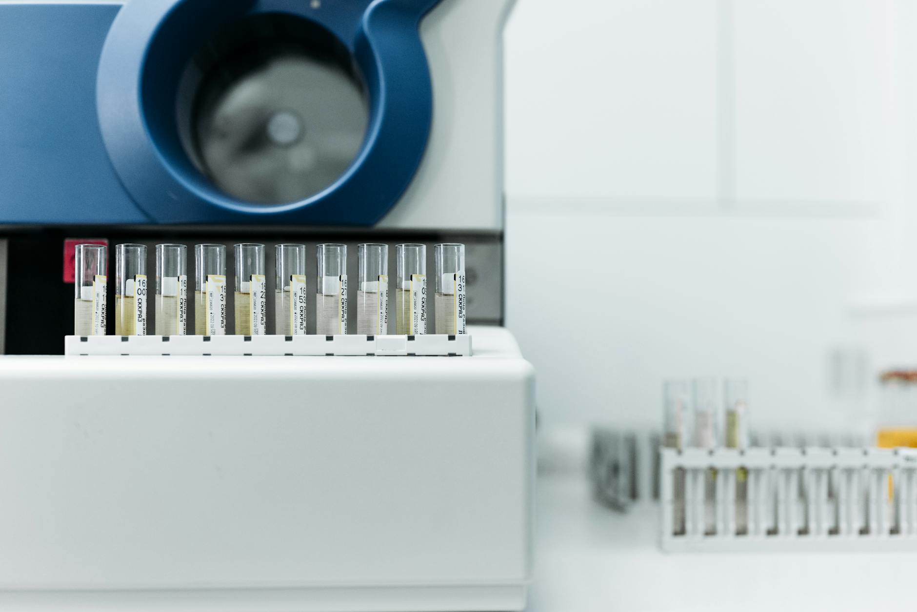 Detailed image of laboratory equipment with rows of test tubes ready for analysis
